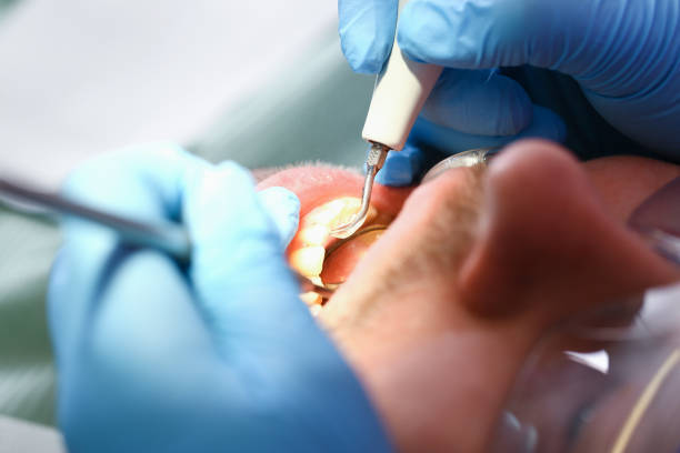 Best Orthodontic Emergency Dentist in Fenton, MI