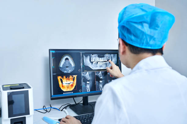 Best Emergency Dental Extractions in Fenton, MI